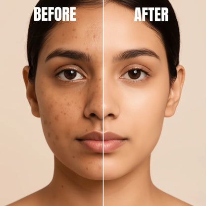 Map 7% (Anti Melasma/Wrinkles)